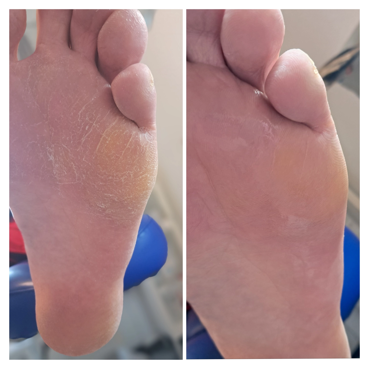Zeitgleiche Kosmetikbehandlung